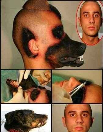 باورنکردنی ترین جراحی دنیا، پیوند سر سگ به بدن پسر جوان
