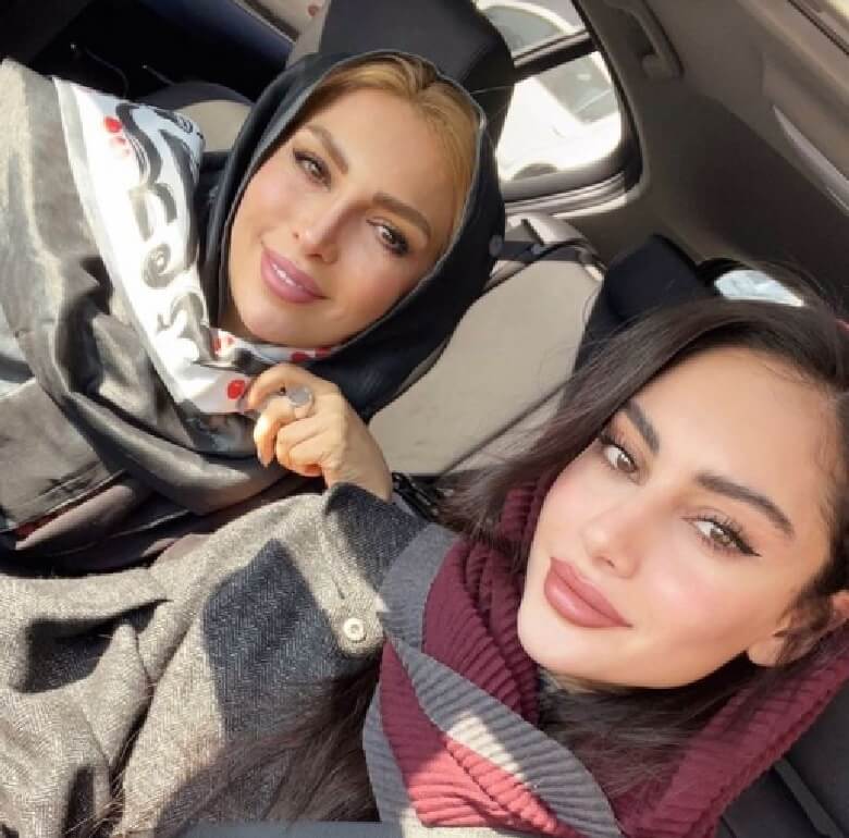 مادر ترلان پروانه عمل زیبایی کرده.