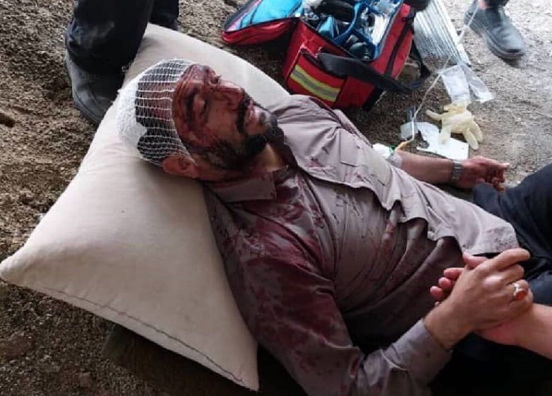 شهردار ناحیه ۳ تهران پس از حمله افراد ناشناس مجروح شد.