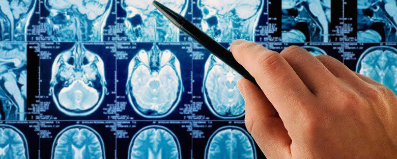 احتمال تومور مغزی را جدی بگیرید.