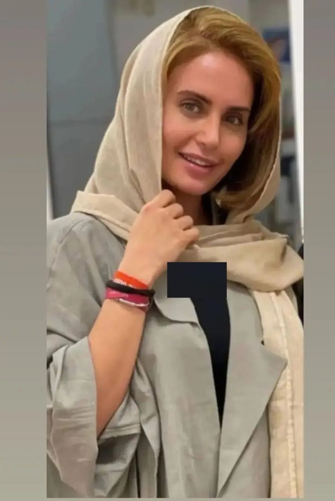 رونمایی الناز شاکردوست از چهره جدیدش