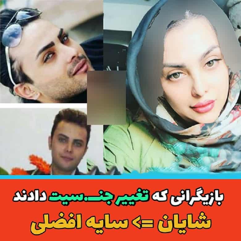 سایه افضلی بازیگران ایرانی که تغییر جنسیت داد.