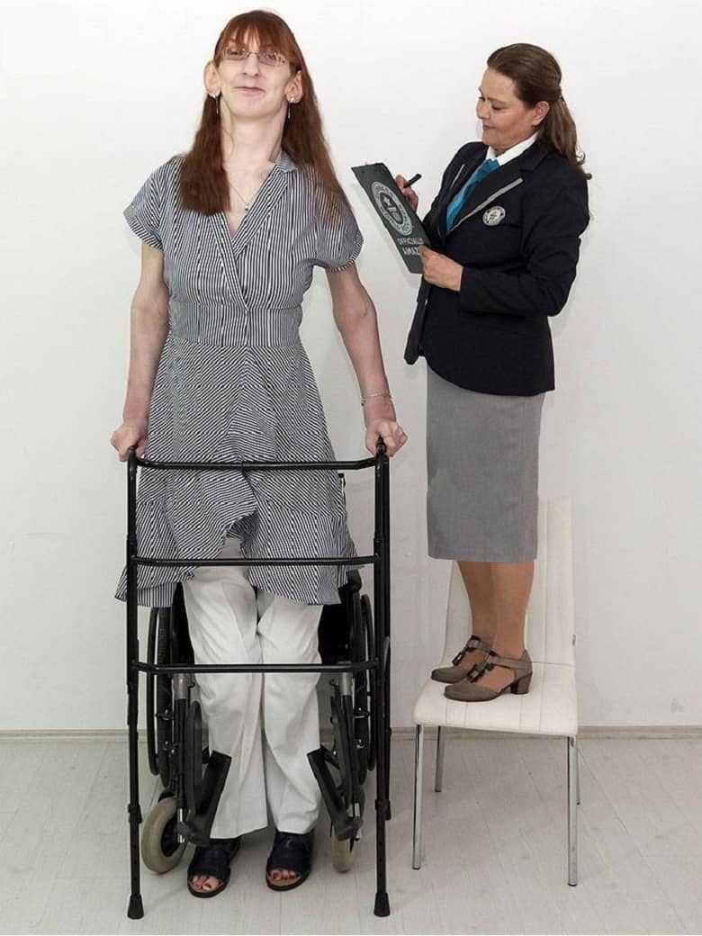 رومیسا گلگی بلندقدترین زن جهان است.