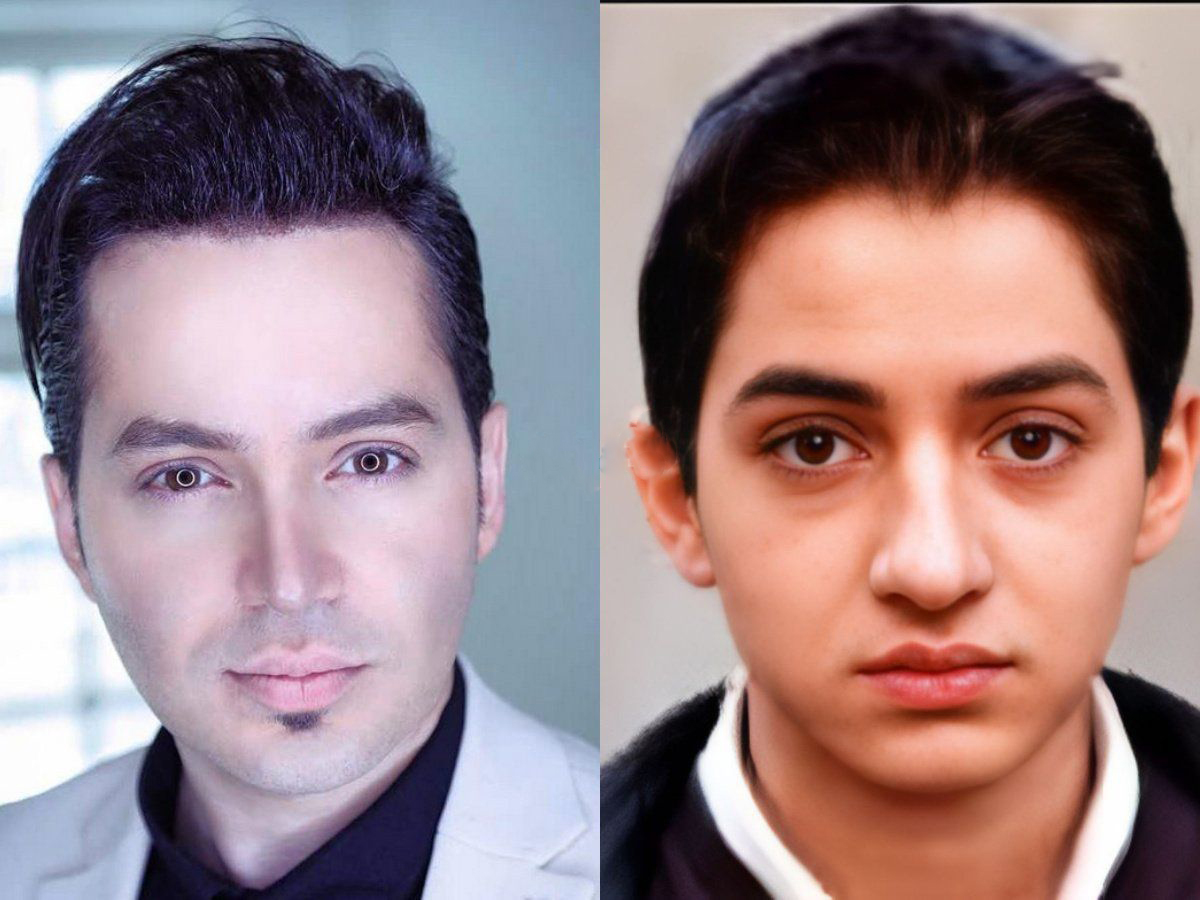 چهره مدلینگی "آقای بازیگرایرانی" بعد عمل زیبایی در 40 سالگی/ عکس