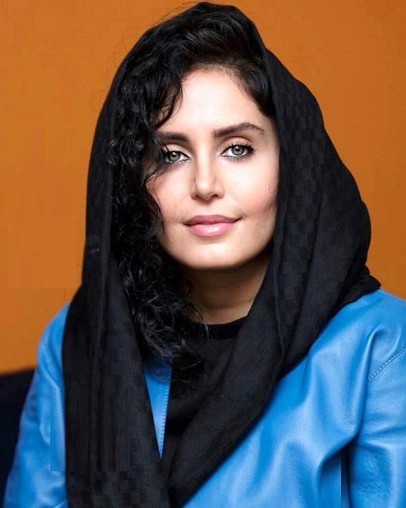 عمل زیبایی چهره "الناز شاکردوست" را عوض کرد/ عکس