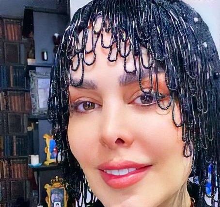 چهره "فلور نظری" بعد عمل های زیبایی شبیه مدل ها شد/ عکس چهره "فلور نظری" بعد عمل های زیبایی شبیه مدل ها شد/ عکس