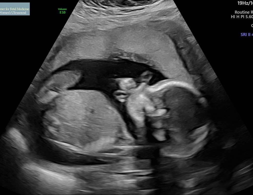 سورپرایز خواننده جنجالی طرفدارانش را شوکه کرد! +عکس سورپرایز خواننده جنجالی طرفدارانش را شوکه کرد! +عکس