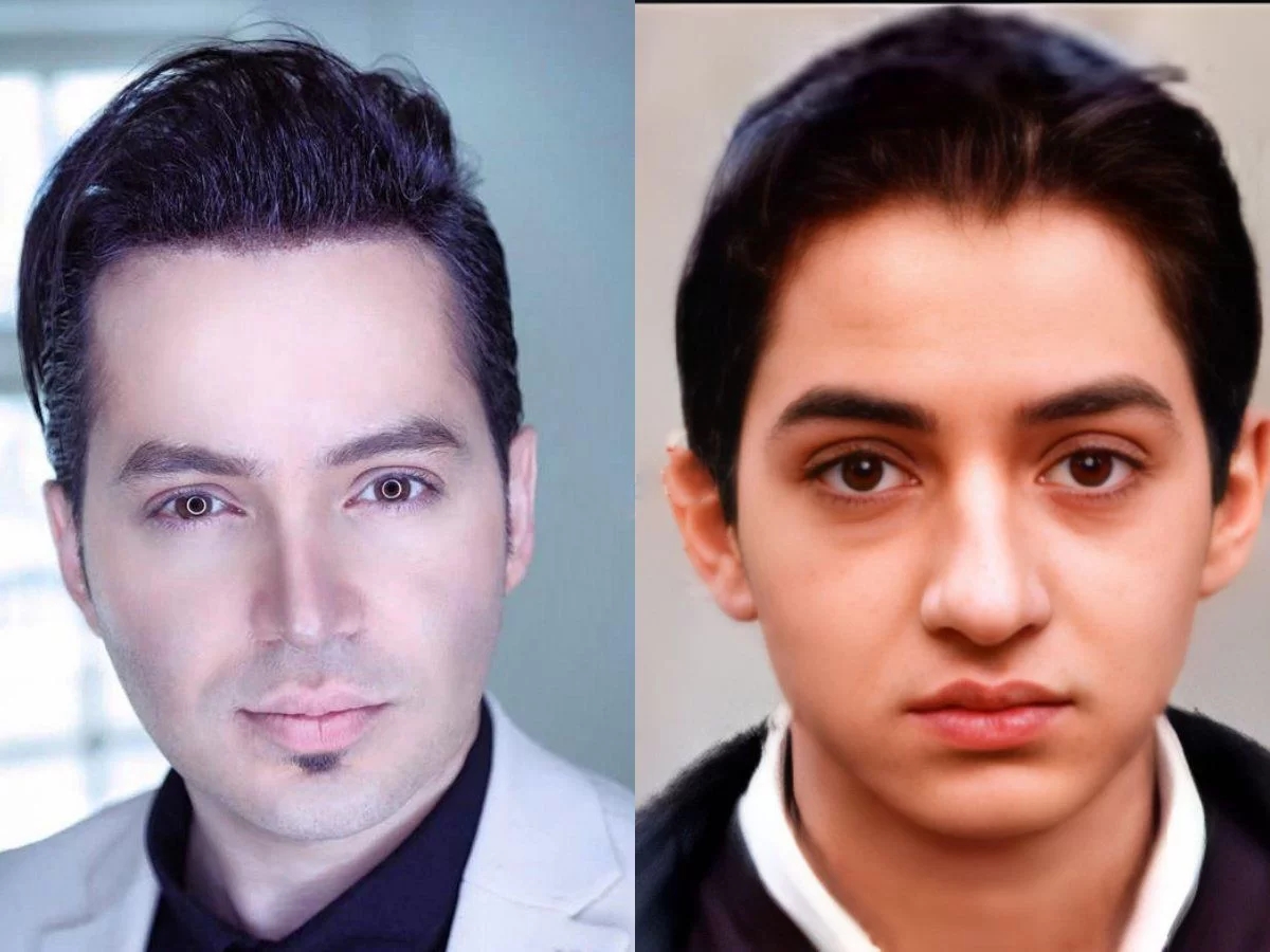 “آقای بازیگر اریانی” با عمل زیبایی در 40 سالگی شبیه مدل ها شد/ عکس