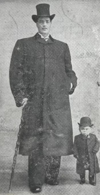 وقوع اتفاقی عجیب، آدم کوتوله ای که به غول تبدیل شد/ عکس