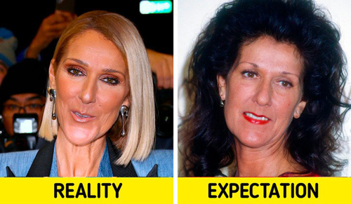 سلبریتی ها بدون عمل های زیبایی این شکلی بودند+عکس