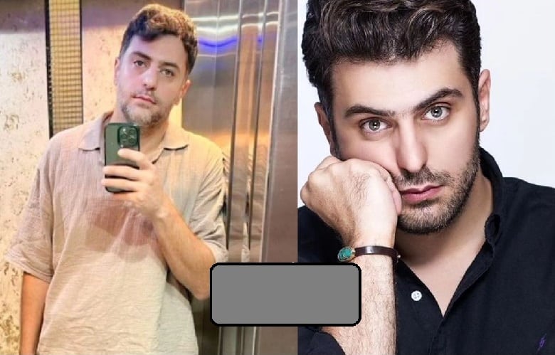 عکس/ چه بلایی بر سر علی ضیا آمده؟