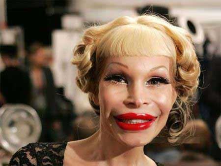 چهره زشت ترین زن جهان را بعد عمل زیبایی ببینید/ عکس