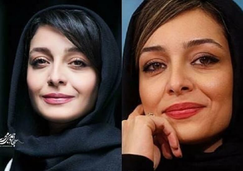 ساره بیات عمل زیبایی نکرده است.