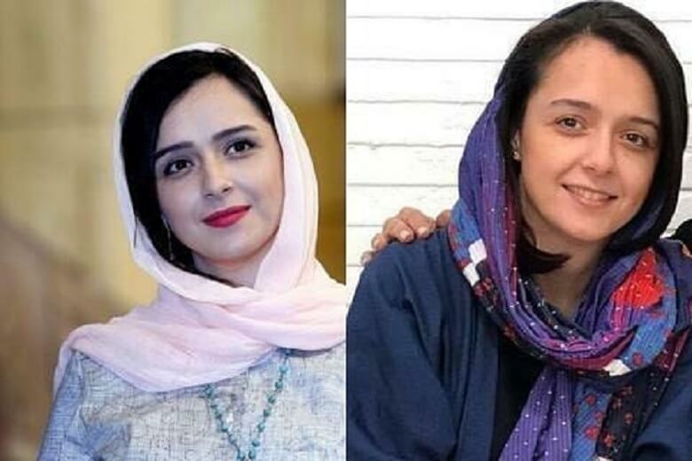 ترانه علیدوستی عمل زیبایی نکرده است.