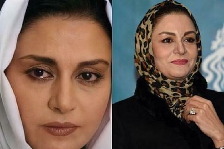 مریلا زارعی عمل زیبایی نکرده است.