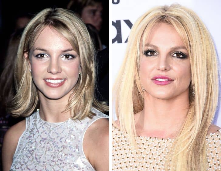 قبل و بعد عمل زیبایی بریتنی اسپیرز