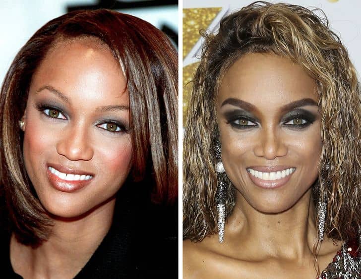 قبل و بعد عمل زیبایی تایرا بنکس