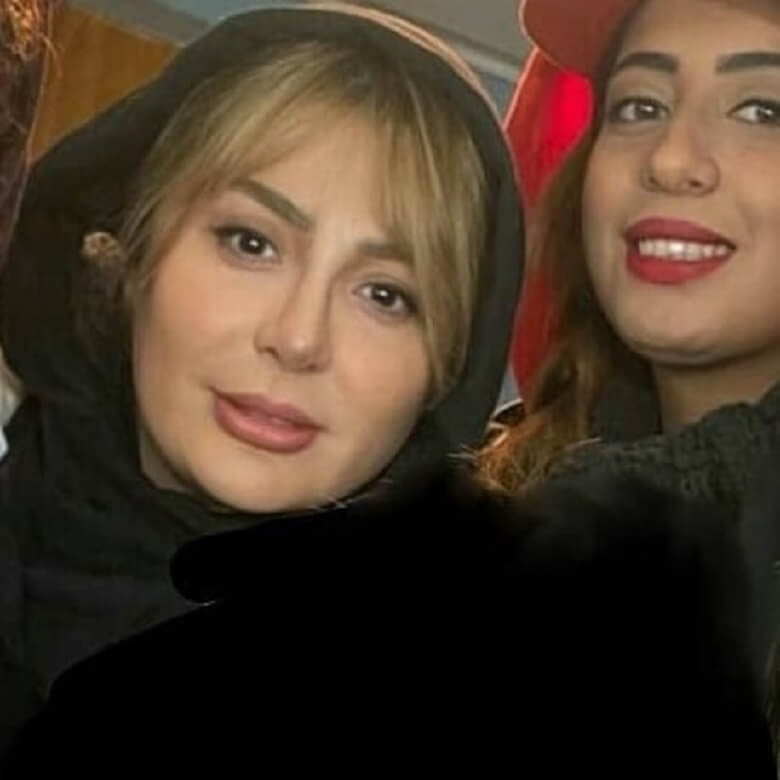 نیوشا ضیغمی قبل از عمل زیبایی این شکلی بود.